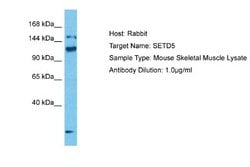 SETD5 Rabbit anti-Mouse, Polyclonal, Novus Biologicals 0.1 mL | Buy Online | Novus Biologicals | Fisher Scientific